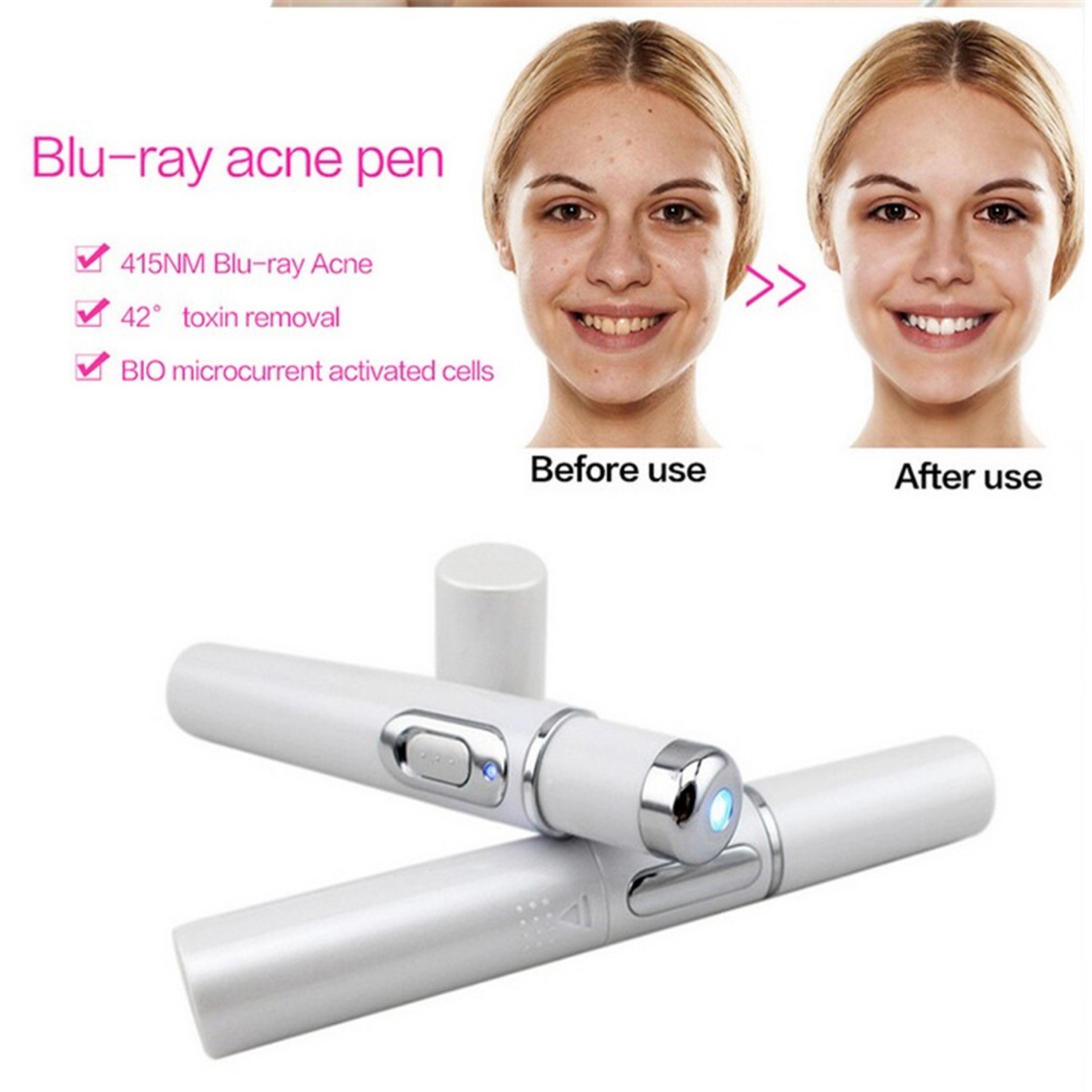 Blue Light Laser Therapy Pen For Acne & Wrinkle Removal - Image 9