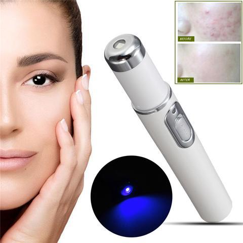 Blue Light Laser Therapy Pen For Acne & Wrinkle Removal - Image 10